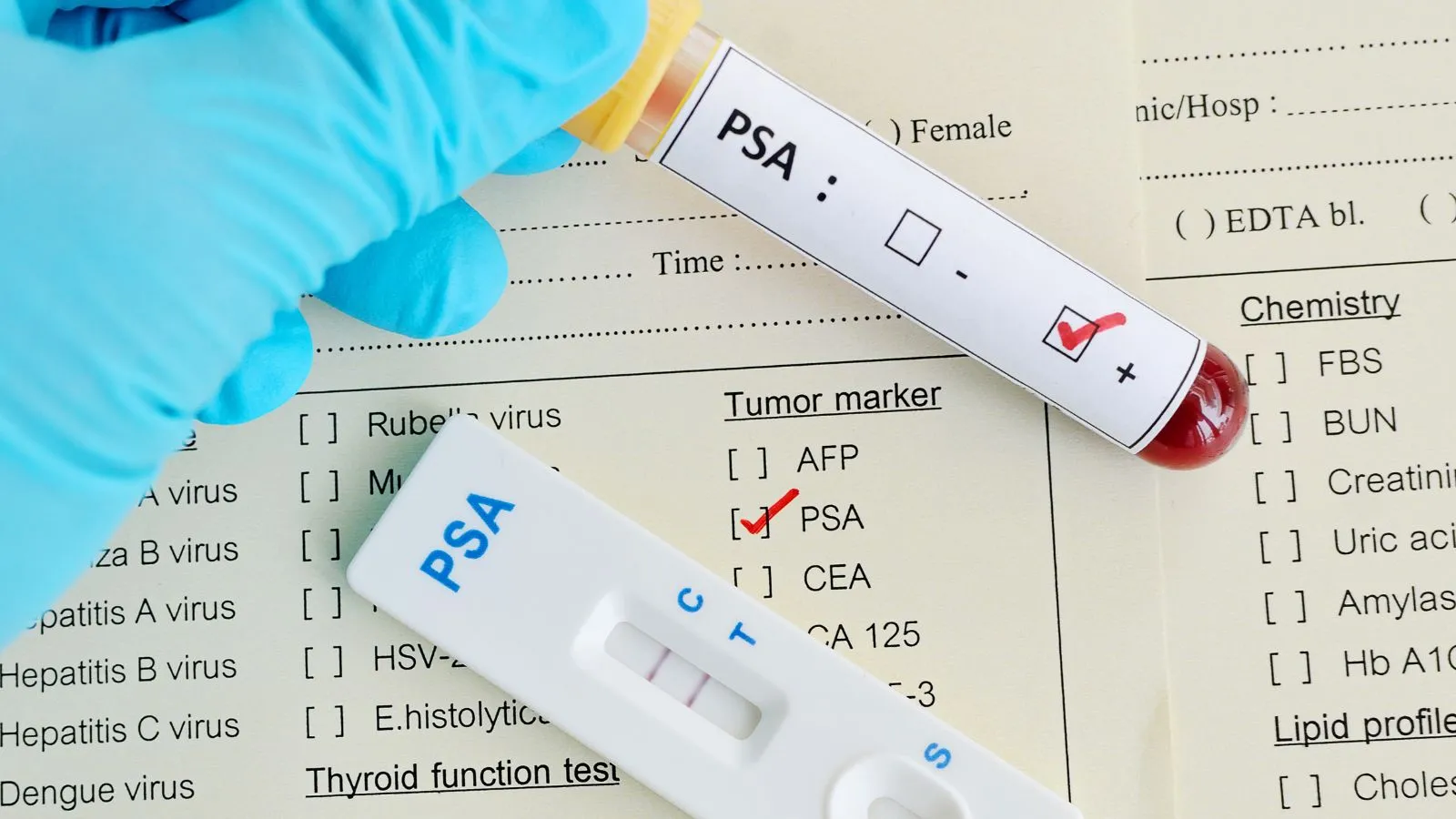 tratamiento de estoma